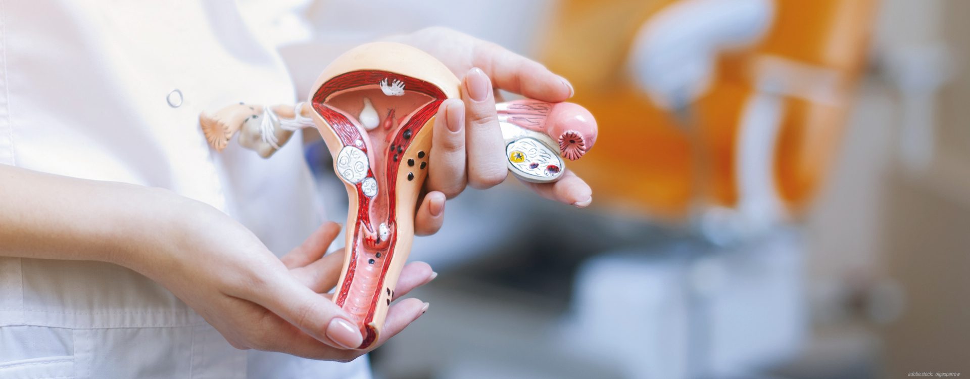 zwei Frauenhände zeigen ein 3D-Modell der weiblichen Gebärmutter