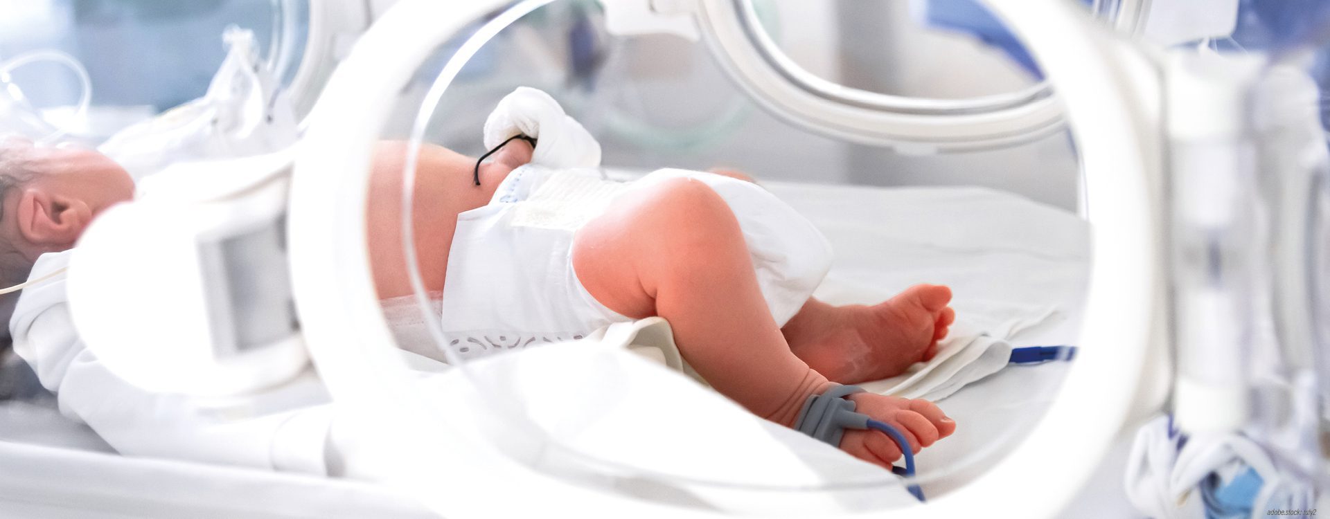 Neugeborenes im Wärmebett auf der Kinderintensivstation