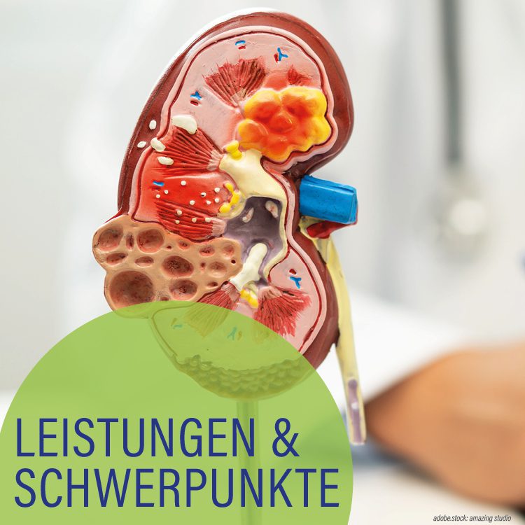 Farbiges 3D-Modell einer menschlichen Niere. Hellgrüner Kreis mit der Aufschrift Leistungen und Schwerpunkte.