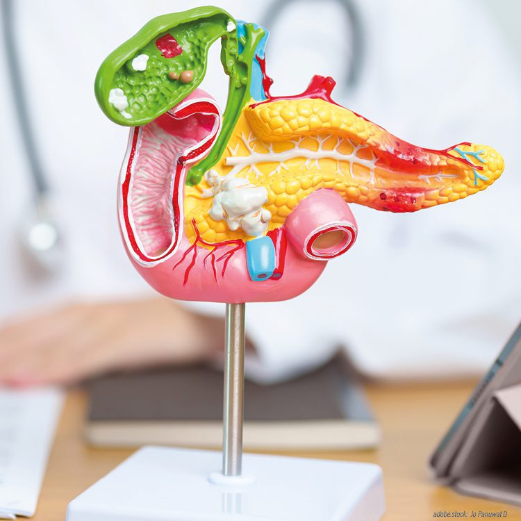 3D-Modell der menschlichen Bauchspeicheldrüse vor einer Person die mit einem blauen Stift auf einem Blatt Papier etwas notiert. Am rechten Rand steht ein Tablett-PC