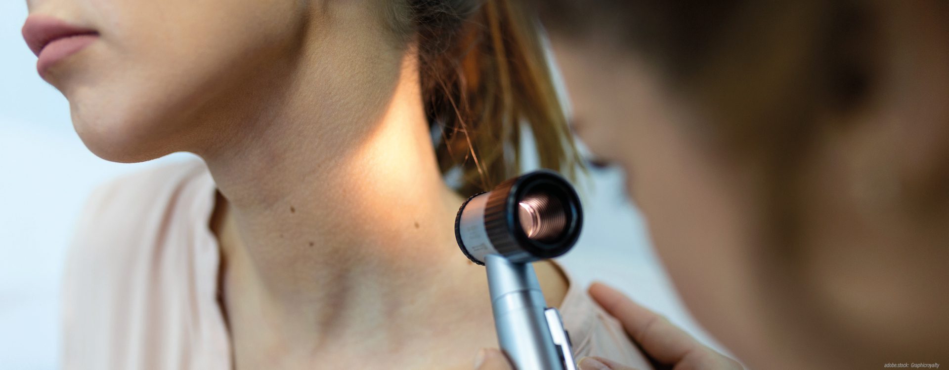 eine Person untersucht ein Muttermal am Hals einer jungen Frau mit einem medizinischen, beleuchteten Vergrößerungsglas