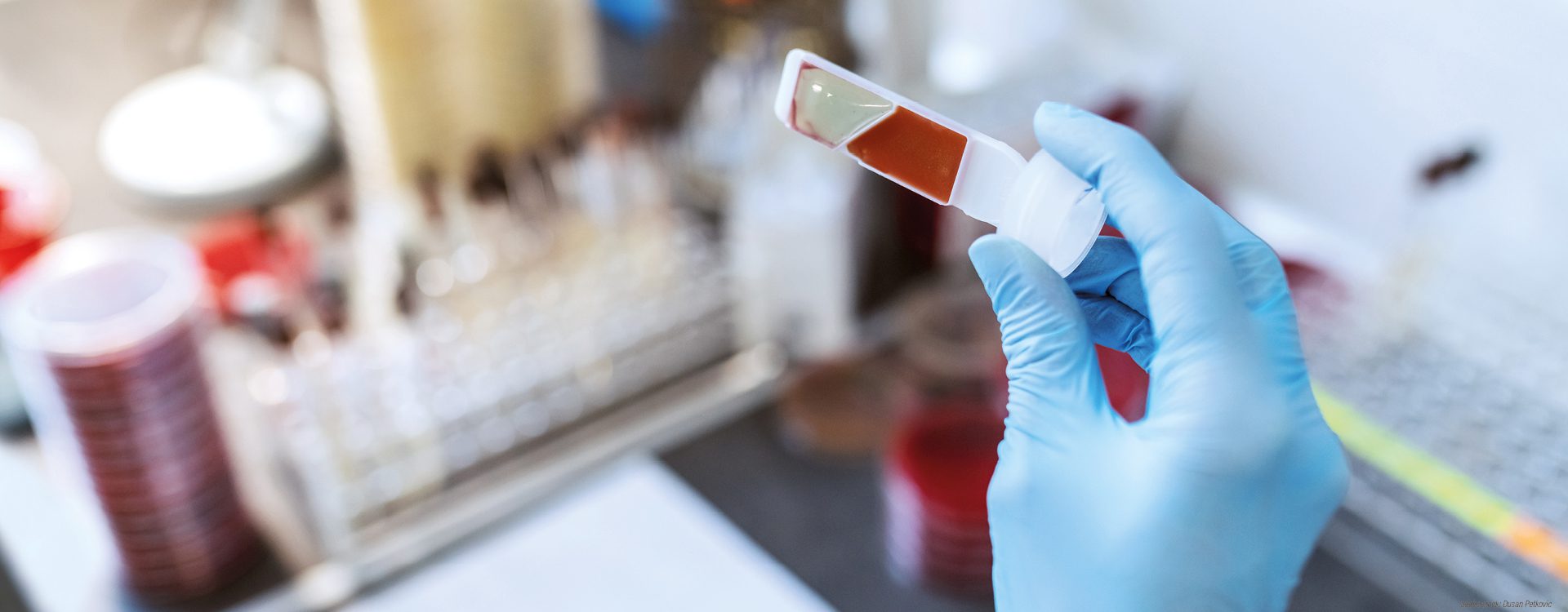 Hand einer Laborfachkraft in Arbeitsschutzkleidung hält einen Untersuchungsstreifen, im Hintergrung unscharf eine Laborsituation.