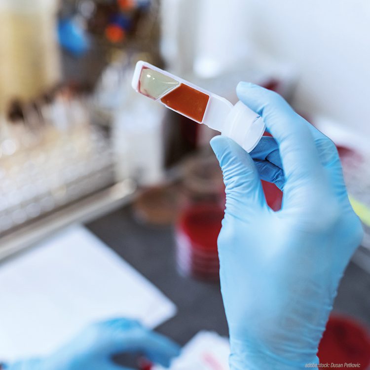 Hand einer Laborfachkraft in Arbeitsschutzkleidung hält einen Untersuchungsstreifen, im Hintergrung unscharf eine Laborsituation