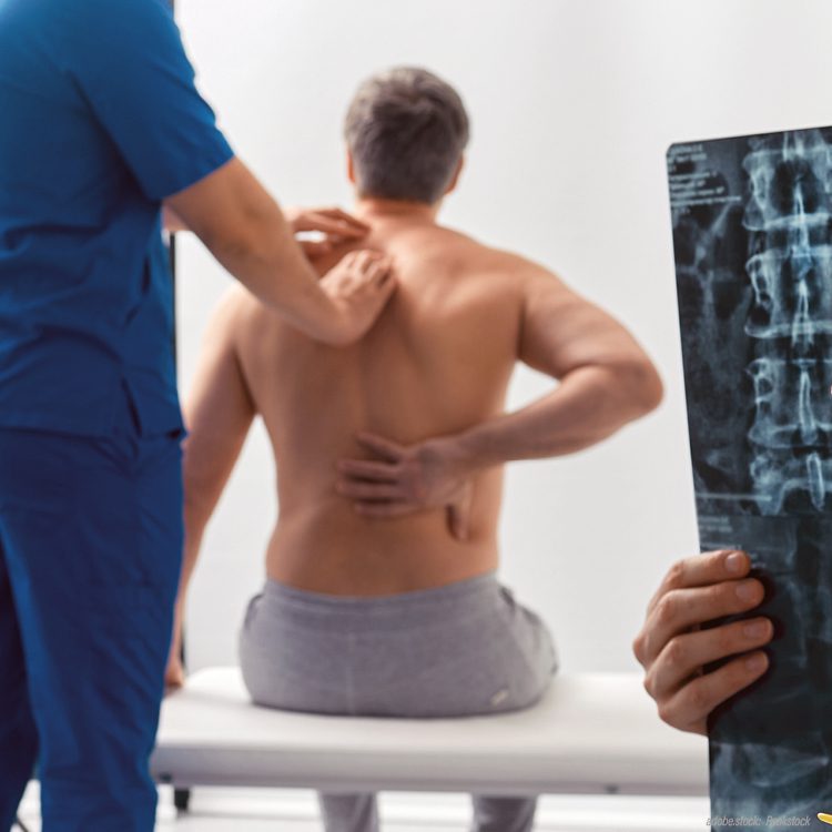 Eine Person in blauer Krankenhaus-Arbeitskleidung untersucht die Wirbelsäule eines sitzenden Mannes. Rechts daneben hält jemand ein Röntgenbild. Davor steht ein 3D-Modell der menschlichen Wirbelsäule.